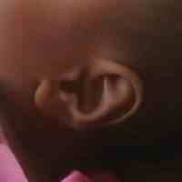 Daun Telinga Bayi Asal Sumenep Berbentuk Lafadz Allah