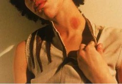 Cupang di Leher yang Bikin Stroke