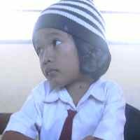 Rizky, Penderita Tumor Telinga Butuh Uluran Tangan Dermawan 