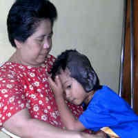 Rizky, Bocah Tumor Telinga Pernah Jalani Operasi