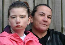 Gadis yang Terlahir Tanpa Ekspresi Wajah