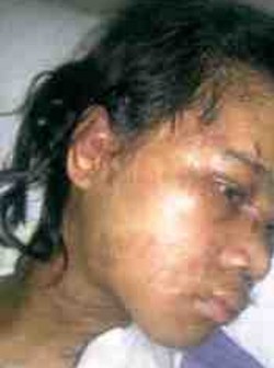 Armayeh Selamat Setelah Lari dari Rumah Majikan di Arab Saudi