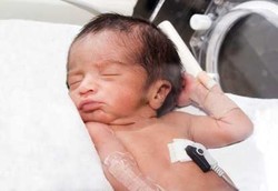 Bayi Lahir Kecil Berisiko Kena Diabetes Saat Dewasa
