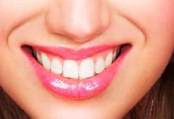 Beginilah Proses Memutihkan Gigi 