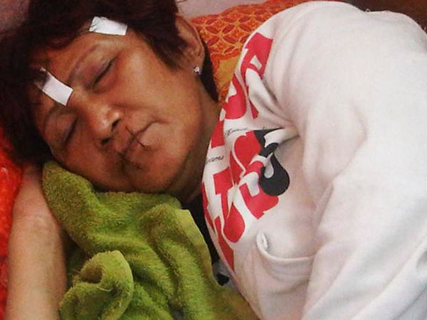 Aksi Jahit Mulut Sampai Mati