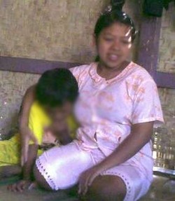 Dirawat Inap di RSHS, In Belum Tahu Kapan Dioperasi