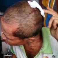 Dianiaya, Kusaeni Mengaku Lahir Batin Tidak Dendam 