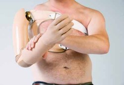 Menkes: Bantu Orang Cacat Tak Cukup dengan Santunan