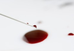 Ketakutan yang Teramat Sangat Bisa Memicu Keringat Darah