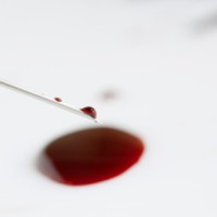 Ketakutan yang Teramat Sangat Bisa Picu Keringat Darah