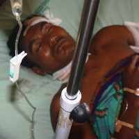 Tergilas Mesin Perahu, Nelayan Situbondo Koma