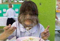 Supatra, si Gadis Monyet yang Berharap Bisa Sembuh