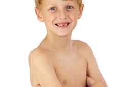 Anak Orang Mampu Juga Bisa Kekurangan Gizi