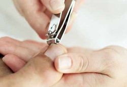 Risiko Kanker Paru Bisa Dilihat dari Kondisi Kuku