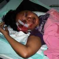 Menolak Diajak Makan, Istri Siri Diinjak-injak Suami