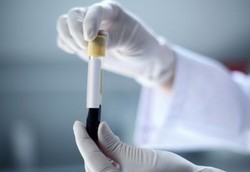 Darah Menstruasi Mengandung Sel Induk untuk Pengobatan