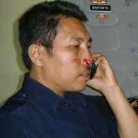 Seorang Guru Babak Belur Dipukuli Preman