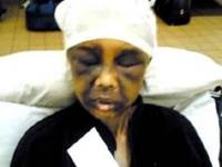 Ada Prosedur Hukum Terlewati, Pengadilan Kasus Sumiati Diulang 