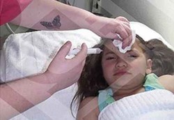 Biar Juara di Kontes Kecantikan, Gadis 8 Tahun Disuntik Botox 