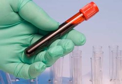 Ditemukan, Teknik Baru untuk Penanganan Kanker Paru