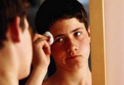 Adakah Hubungan Jerawat dan Masturbasi?