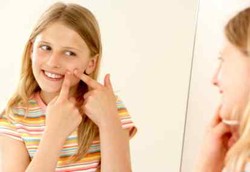 Cara Aman Memencet Jerawat Agar Tidak Berbekas 