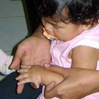 Agni, Balita Malang dengan 26 Jari