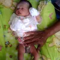Bayi Lahir dalam Kondisi Alat Kelamin Tersunat
