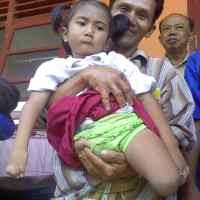 Tak Punya Kaki dan Jemari Tangan Tak Utuh, Dewi Berusaha Mandiri