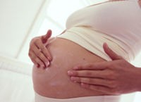 Apa Stretch Marks Bisa Hilang?