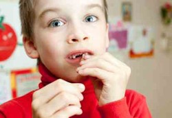 Gigi Susu Dipakai untuk Membangun Istana