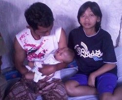 Anak Lahir Tanpa Mulut & Hidung, Warga Lereng Merapi Butuh Bantuan