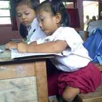 Orangtua Berharap Dewi Kenakan Kaki Palsu Disaat Remaja