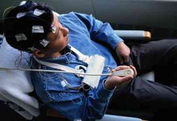 Kejang Epilepsi Bisa Jadi Gejala Awal Tumor Otak