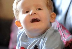 Bocah dengan DNA Sangat Aneh yang Bikin Dokter Bingung