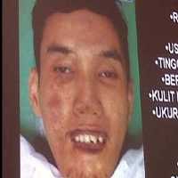 Sarip Mirip Terduga Pelaku Bom, Cuma Giginya Berbeda