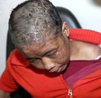 Seorang TKI di Yordania Disiksa Hingga Buta