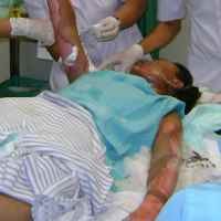 Rumah Terbakar, Sekujur Tubuh Siswi SMK Melepuh