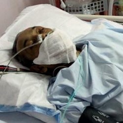 Franky Sahilatua Mulai Sakit Sejak Juli 2010