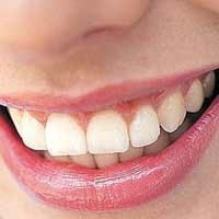 Pola Makan Pengaruhi Perubahan Warna Gigi