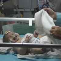 Orang Tua Bayi Kelainan Jantung Tak Punya Firasat