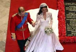 Cegah Kebotakan di Usia Muda Agar Tak Seperti Pangeran William