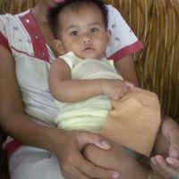 Bantuan Anak Tukang Becak Tanpa Anus di Pamekasan Disalurkan