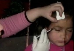 Gadis 8 Tahun yang Disuntik Botox Akhirnya Masuk Perawatan