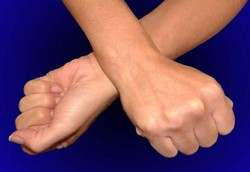 Menyilangkan Tangan Bisa Mengurangi Rasa Nyeri