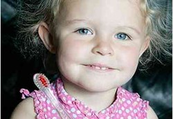 Balita Selamat dari Kanker Mata Karena Sikat Gigi