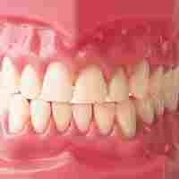 Gigi Palsu Anggota DPRD Kabupaten Malang Diasuransikan