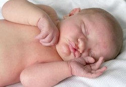 Bayi Bibir Sumbing Bukan Karena Ibu Hamil Pakai Steroid