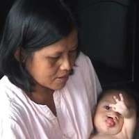 Kisah Bayi Berusia 8 Bulan yang Alami Sejumlah Cacat Fisik