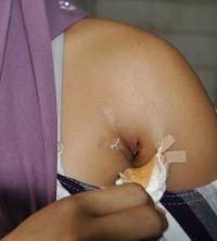 Kasus Penembakan di PT SMM Dilaporkan ke Komnas HAM